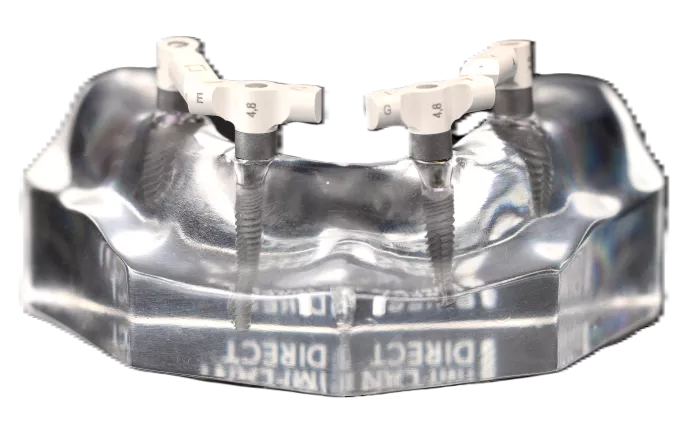 Directscan Scan Adapters on a Typodant