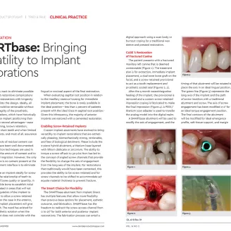 SMARTbase Case Presentation